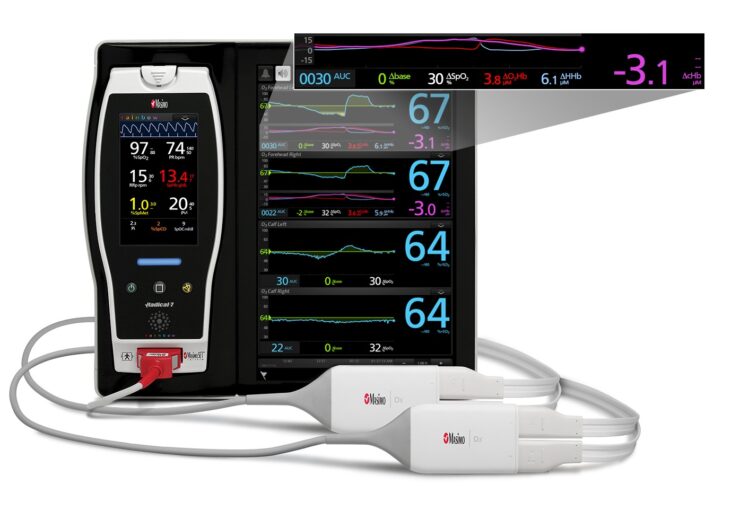 Masimo’s O3 Regional Oximetry approved for use in cerebral and somatic applications