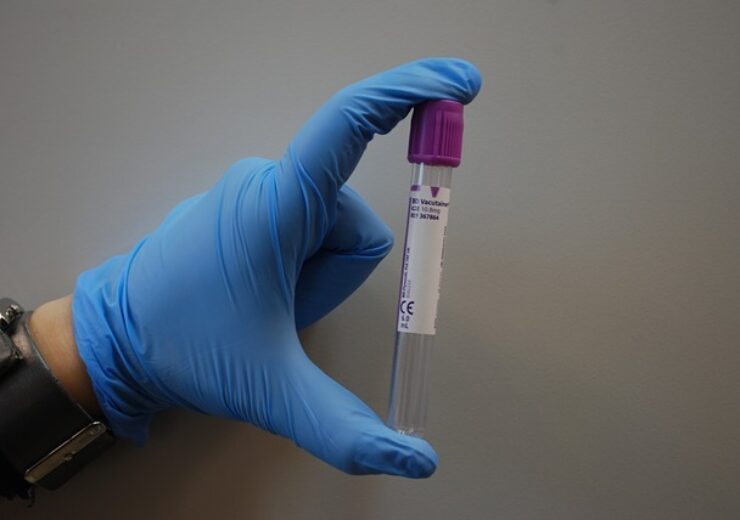 Chembio submits EUA application for new DPP SARS-CoV-2 IgM/IgG test system