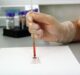 US lab authority says ‘chronic shortage’ of testing talent hindering Covid-19 diagnosis efforts