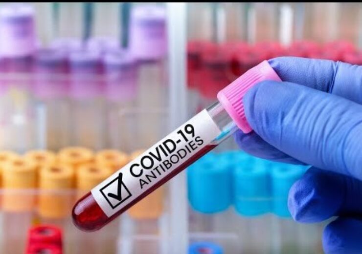 Beckman Coulter gets FDA EUA status for SARS-CoV-2 IgM antibody test