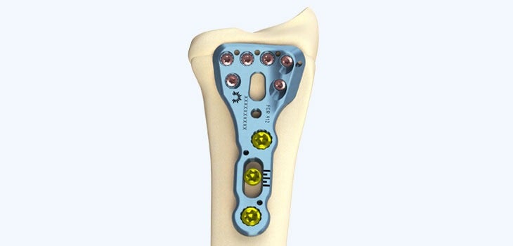 medical device investments 2020