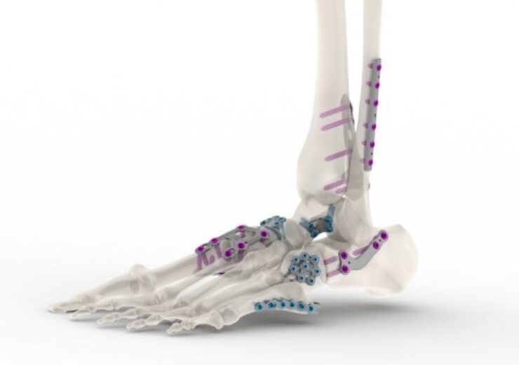 FDA approves Tyber Medical’s foot and ankle plating systems
