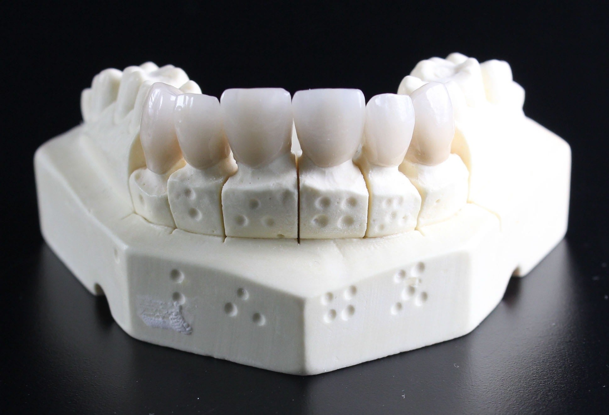 ceramics dental applications