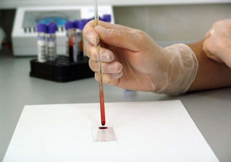 FDA approves Cerus’ INTERCEPT blood system for cryoprecipitation