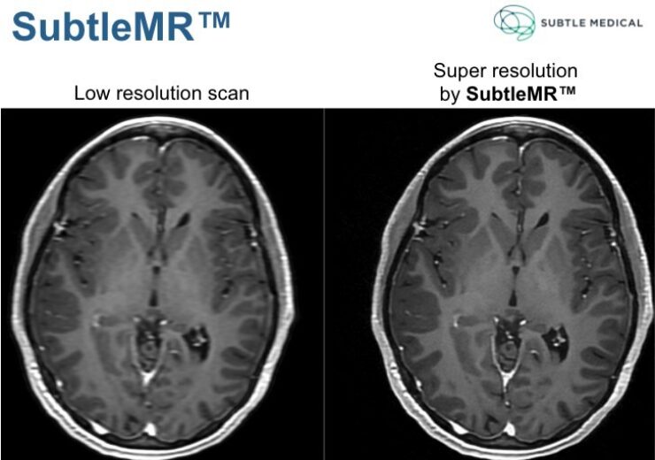 Subtle Medical raises $12.2m in Series A funding to expand its AI imaging solutions