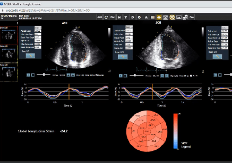 Konica Minolta and DiA expand AI-based echocardiography analysis and reporting on Exa Cardio PACS Platform