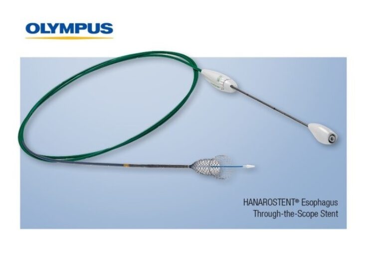 Olympus launches HANAROSTENT esophagus through-the-scope stent