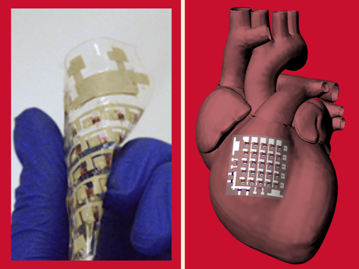 rubbery electronics heart implant