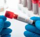 UK government ‘buried’ negative data on its favoured coronavirus antibody test, claims BMJ