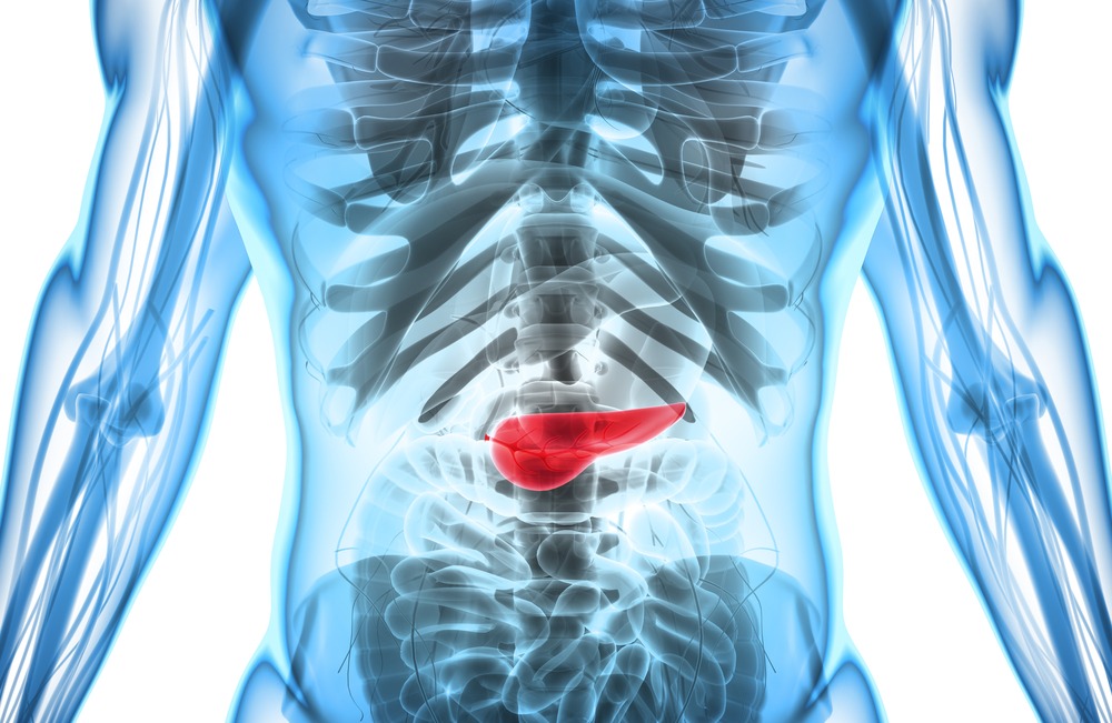 Could a newly-funded endoscopic biopsy sampling device improve pancreatic cancer diagnosis?
