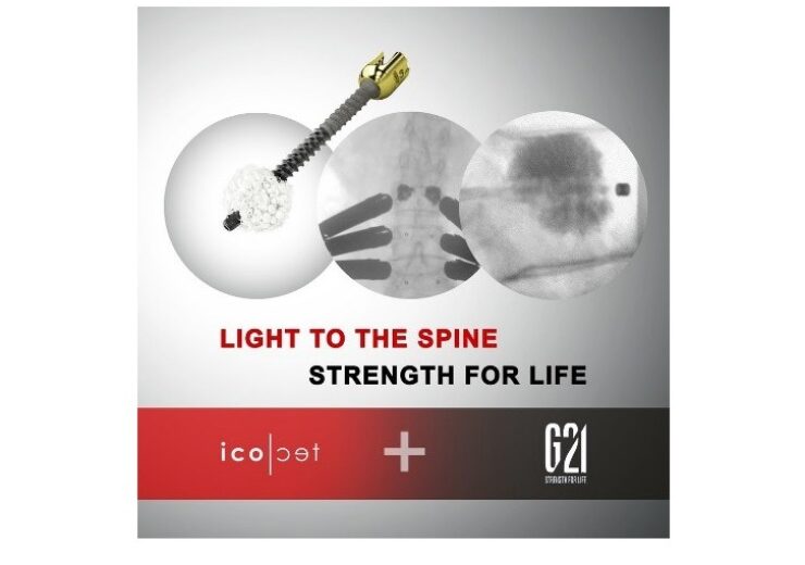 icotec ag partners with G-21 to provide combined bone cement and delivery solution for pedicle screw augmentation procedures