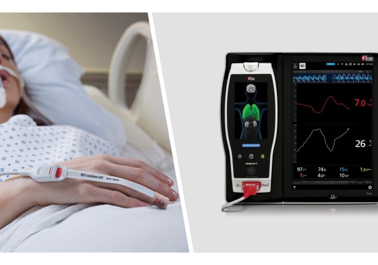 Study Comparing Two Noninvasive Indicators of Fluid Responsiveness on Mechanically Ventilated Patients Finds Masimo PVi® Effective and Advantageous
