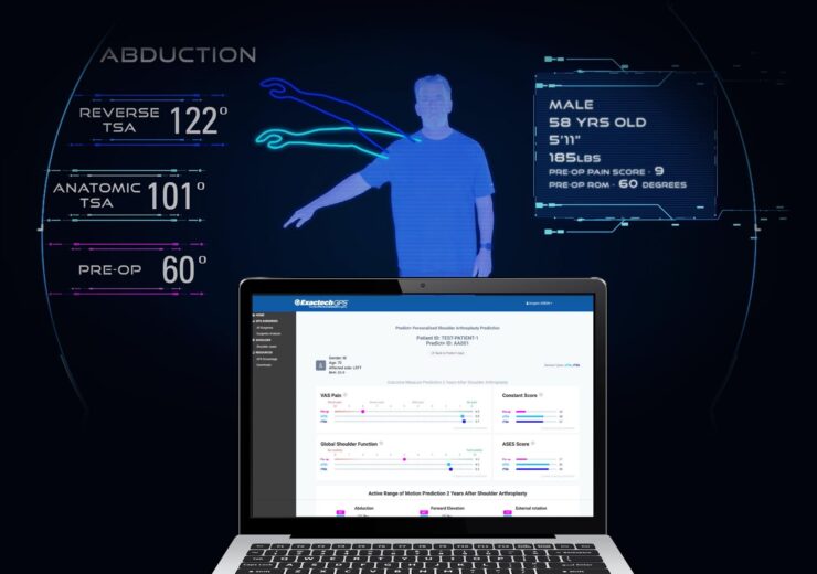 Exactech Launches Predict+™, First Machine Learning-Based Software that Informs Surgeons with Patient-Specific Outcomes Predictions After Shoulder Replacement Surgery