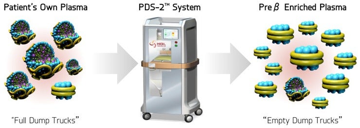 Plasma Delipidation System