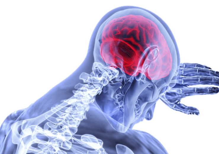 BRAINBox begins HeadSMART II study of its brain trauma test