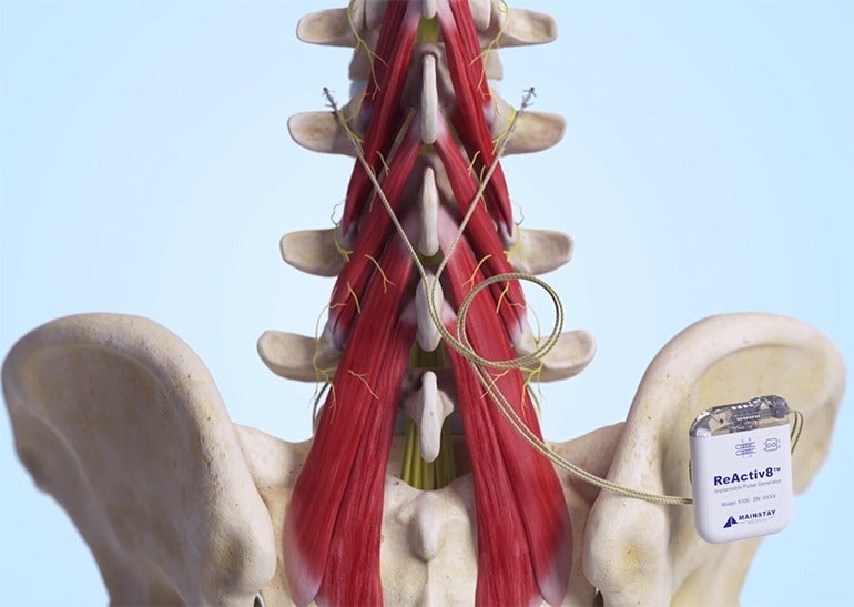 ReActiv8 Implantable Neurostimulation System fda approved medical devices 2020