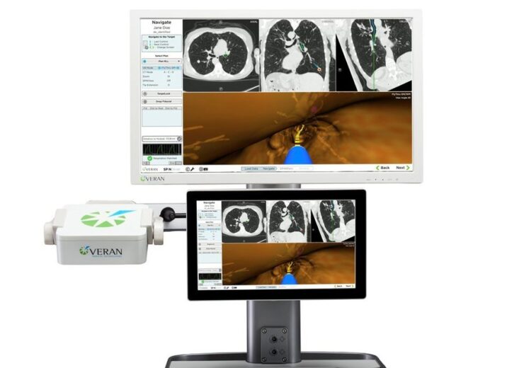Olympus acquires interventional pulmonology devices firm VMT