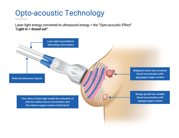 Seno Medical gets FDA nod for Imagio breast cancer diagnostic technology