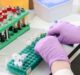 PerkinElmer to buy diagnostics firm Oxford Immunotec Global for $591m