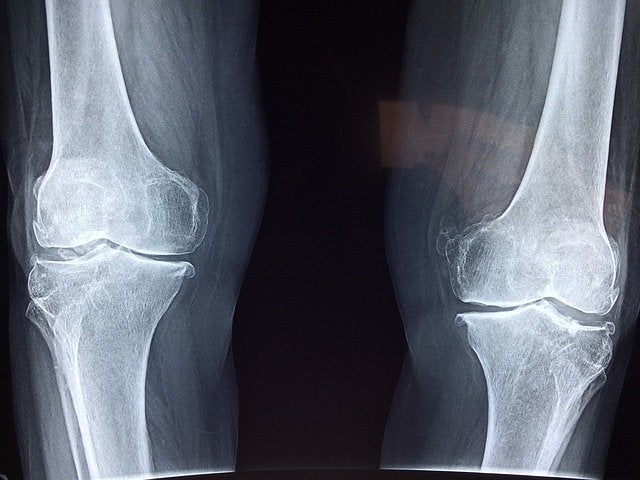 knee-2253047_640