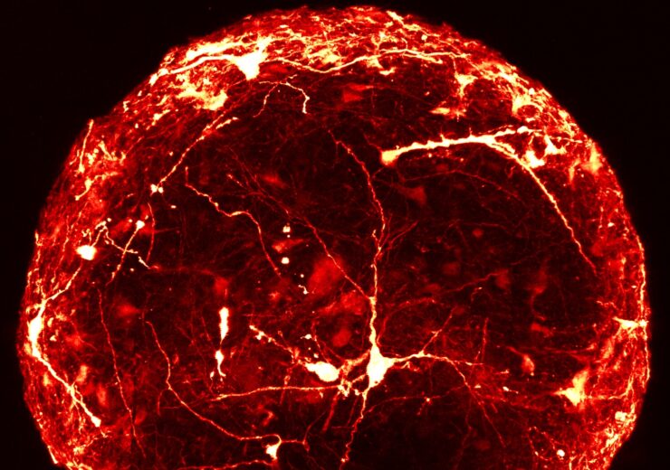 Swiss researchers produce 3D images of artificial ‘mini-brains’ for the first time