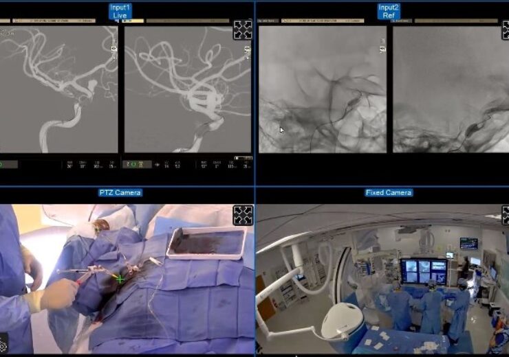 Live remote supervision of neuroendovascular surgery enabled by Olympus MedPresence
