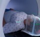 Four major advances made in external radiotherapy for treating cancer