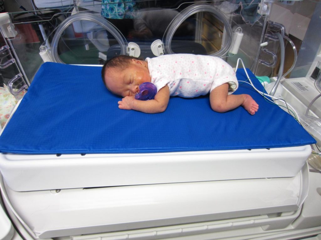 Therapeutic bed equal to parental comfort in managing pain in pre-term babies in the NICU