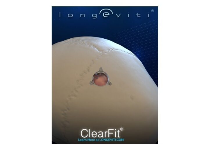 Longeviti introduces new ClearFit Cover for brain surgery patients
