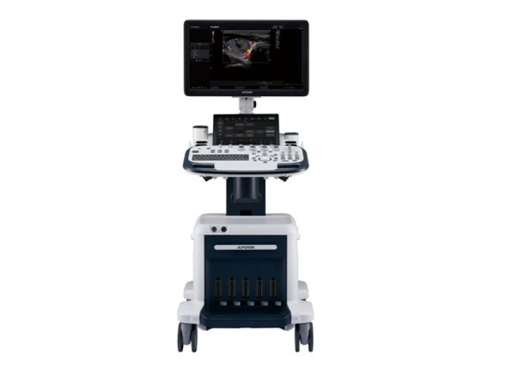 ALPINION launches X-CUBE 90 ultrasound diagnostic system