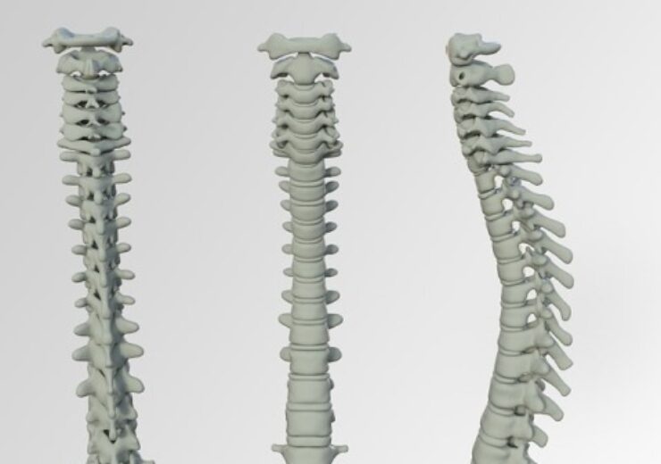 FDA approves Life Spine’s PROLIFT wedge expandable spacer system