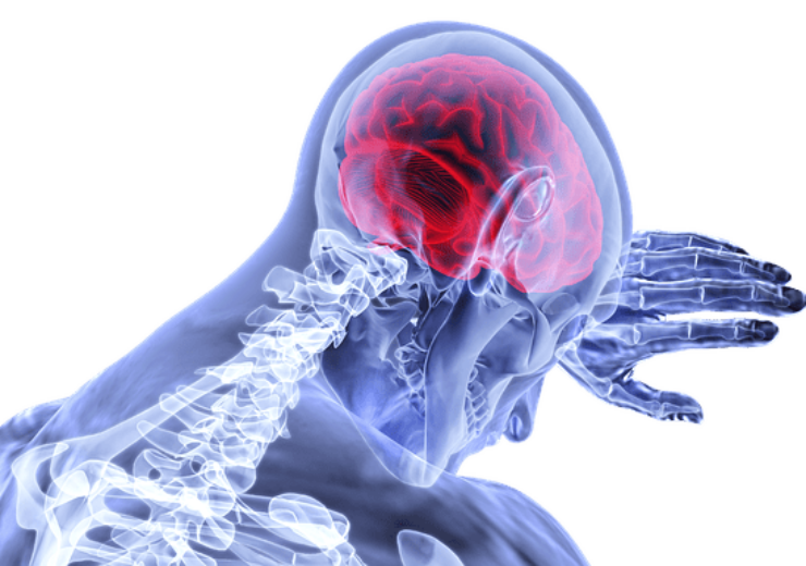 FDA approves Neurolief’s Relivion brain neuromodulation system to treat migraine
