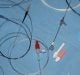 Varian Medical Systems Invests in Bend It Technologies, Ltd., a Company Developing Novel Steerable Microcatheters