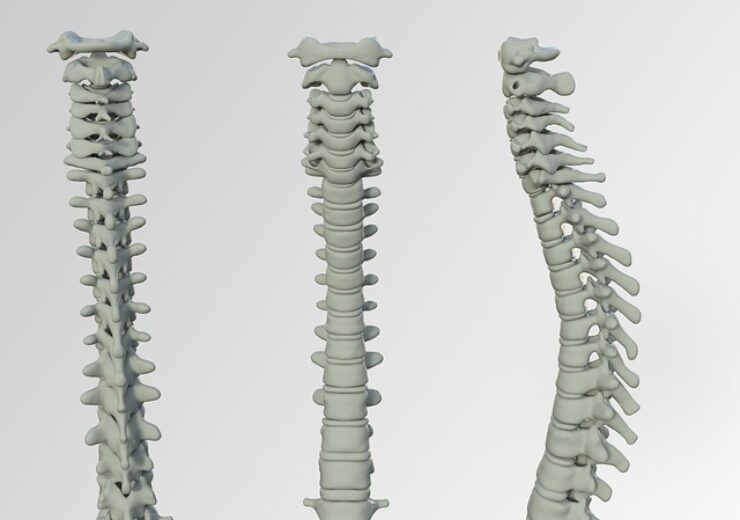 spineproduct