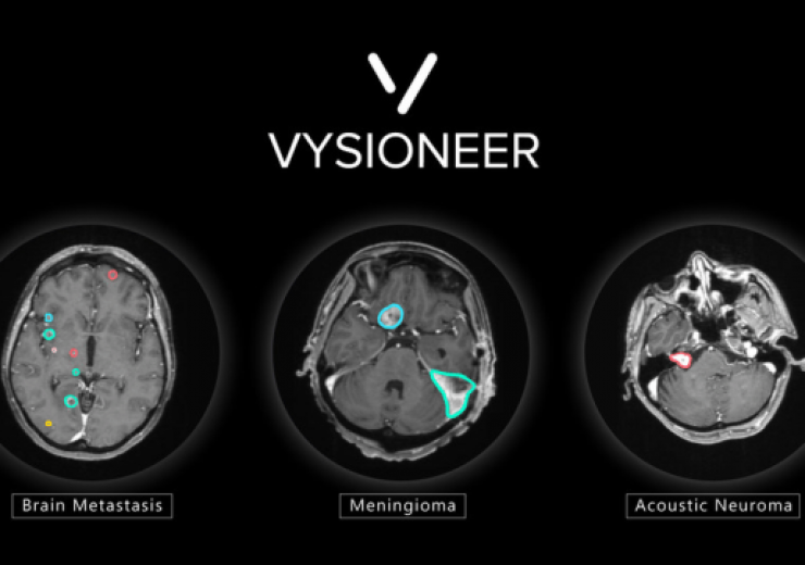 Vysioneer gets FDA nod for VBrain AI-based tumour auto-contouring solution