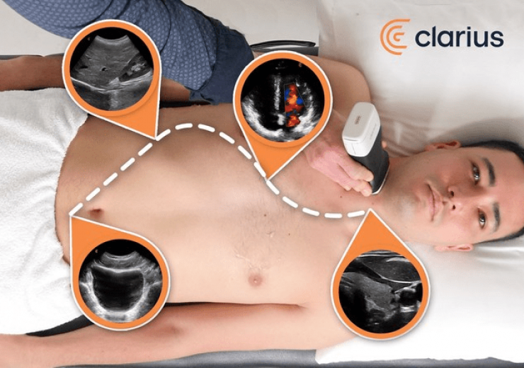 Clarius introduces first ultrasound system that uses AI and machine learning to recognise anatomy for instant window into body