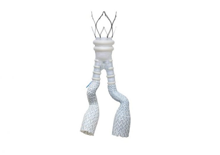 Endologix announces launch of ALTO abdominal stent graft system in Canada and Argentina