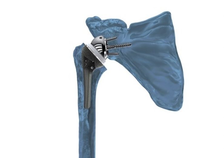 Catalyst OrthoScience announces first surgeries using Archer R1 reverse shoulder system