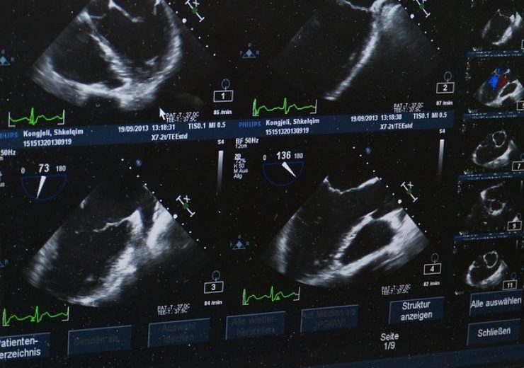 Mindray launches New General Imaging, Women’s Healthcare and Cardiology Ultrasound Solutions