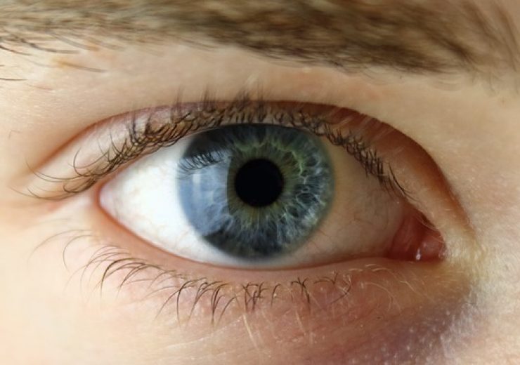 VisionQuest Uses Artificial Intelligence to Screen 40,000 Patients for Diabetic Retinopathy