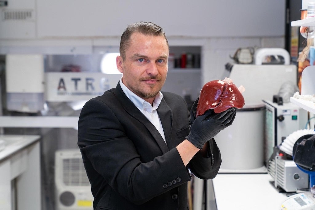 Who ordered the liver? A 3D-printed replica could make difficult procedures easier by allowing surgeons to rehearse before theatre