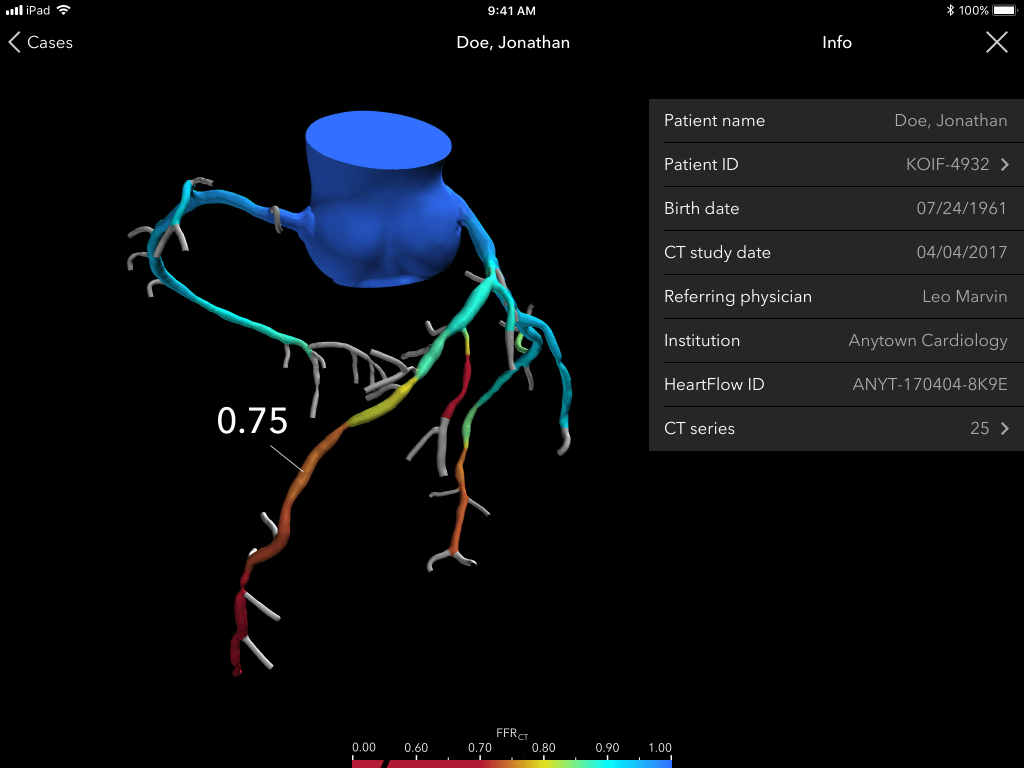 3d heart scan