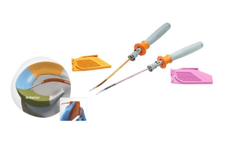 Smith+Nephew launches the FAST-FIX™ FLEX Meniscal Repair System; extends all-inside repair possibilities with greater access across all zones of the meniscus