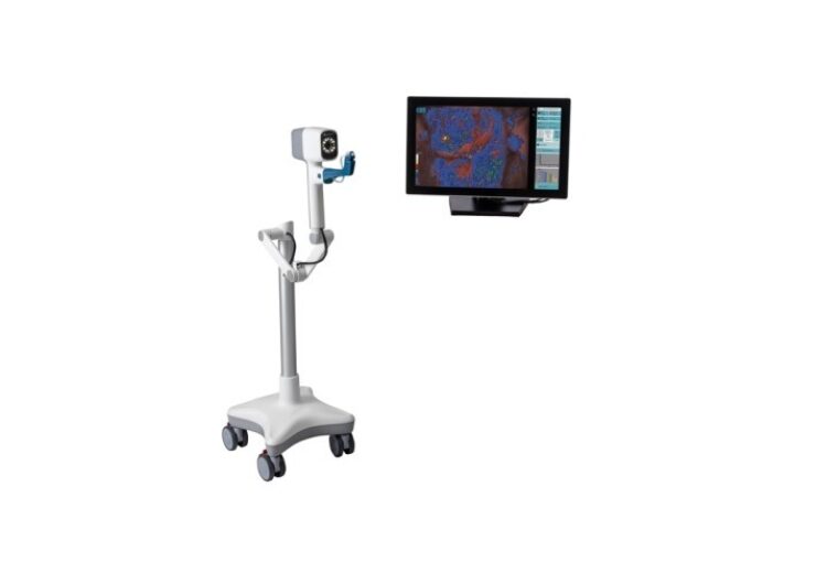 DYSIS Medical launches new colposcope with computer-aided cervical mapping