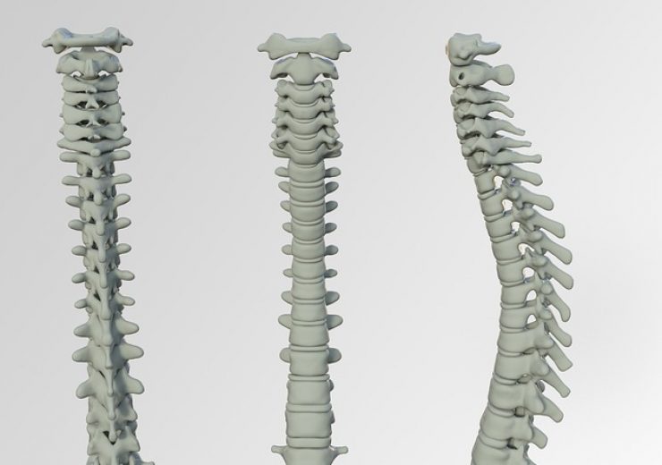 FDA approves SeaSpine’s 7D surgical percutaneous spine module