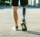 How patient-focused technology can improve prosthetics
