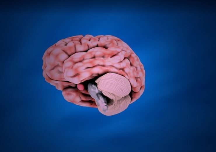 Qure.ai gets FDA nod for Brain CT AI product