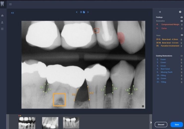 Overjet secures $27m funding for AI-driven dentistry