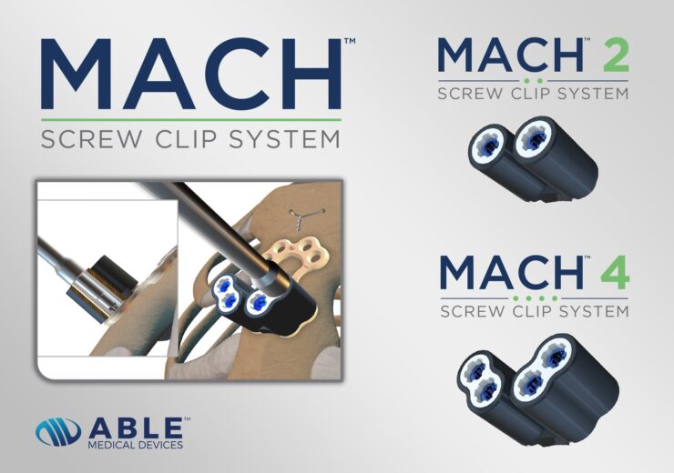 Able Medical Announces FDA 510K Clearance for the MACH Screw Clip System