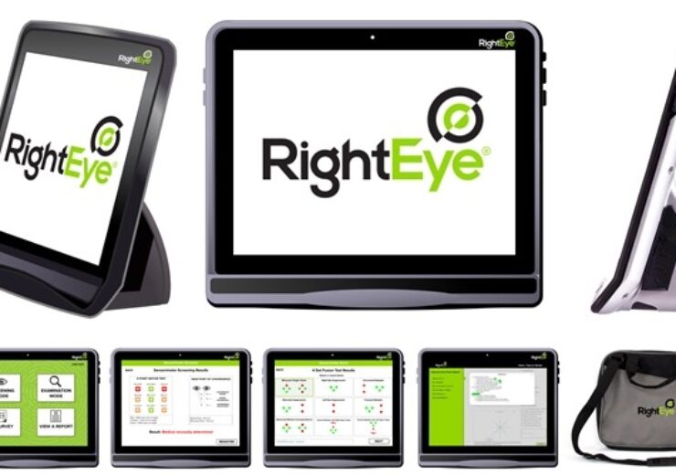 RightEye introduces new automated sensorimotor exam system